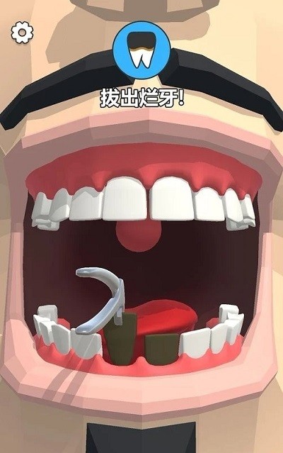 拔牙吗我贼6