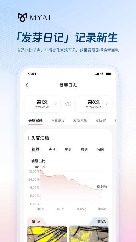 MYAI护发日记